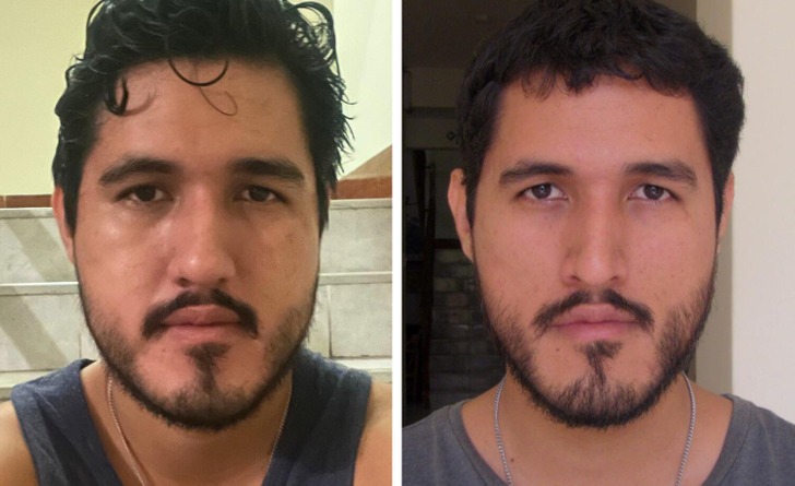 13 Before-and-After Photos That Tell a Whole Story