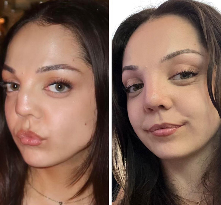 13 Before-and-After Photos That Tell a Whole Story