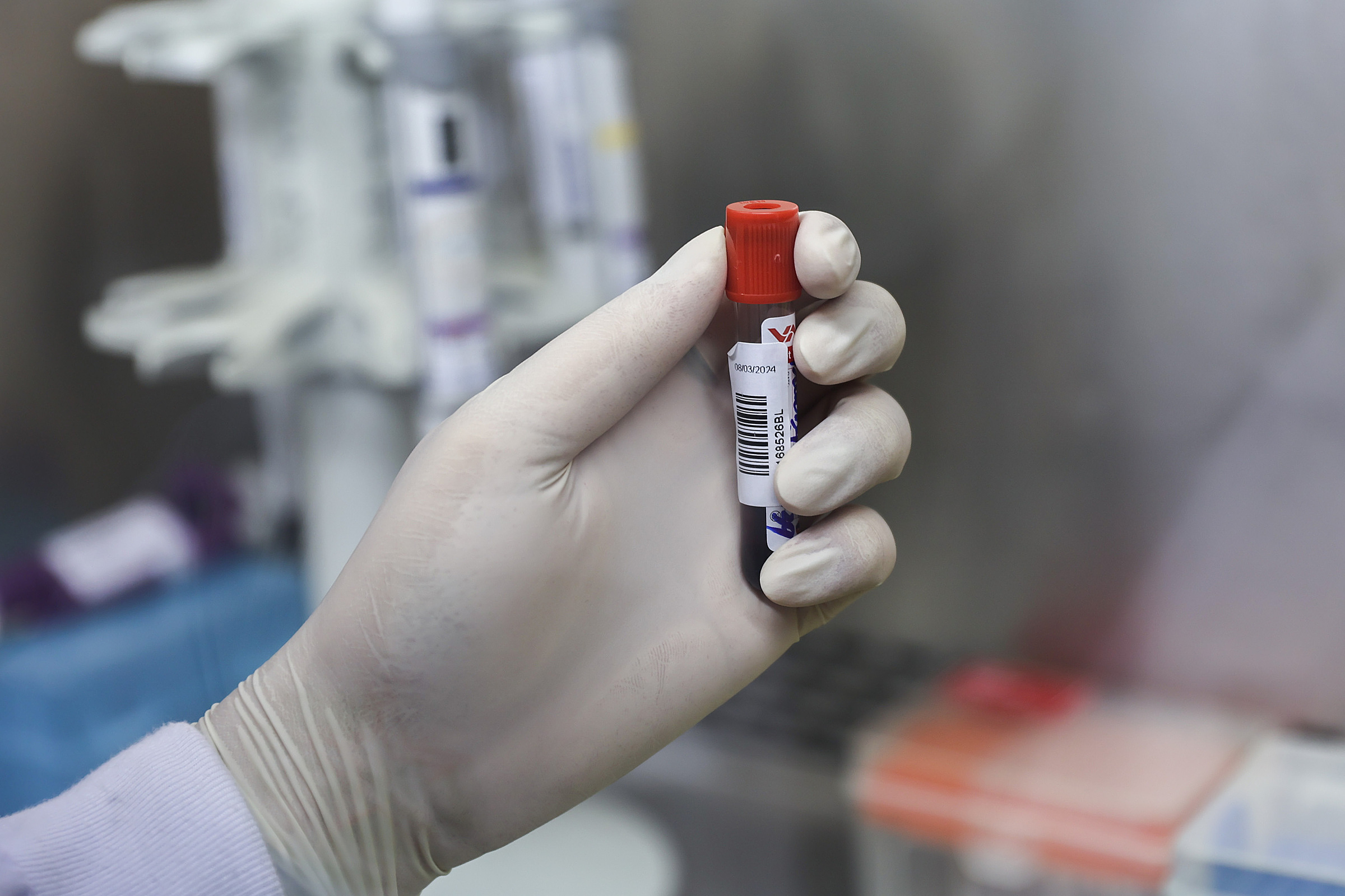 Hai 'kẻ thù' thầm lặng khiến mỡ máu cao