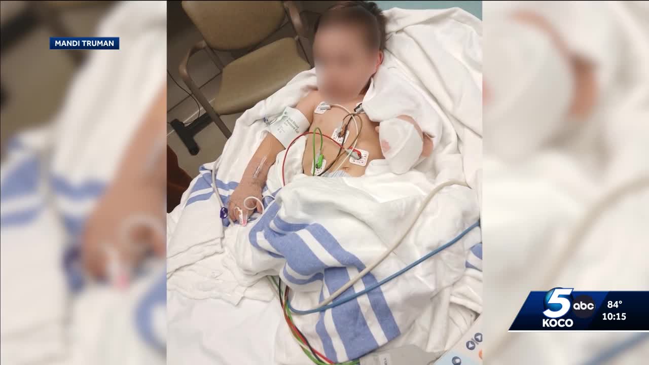 Oklahoma grandmother warns parents after grandson loses finger in