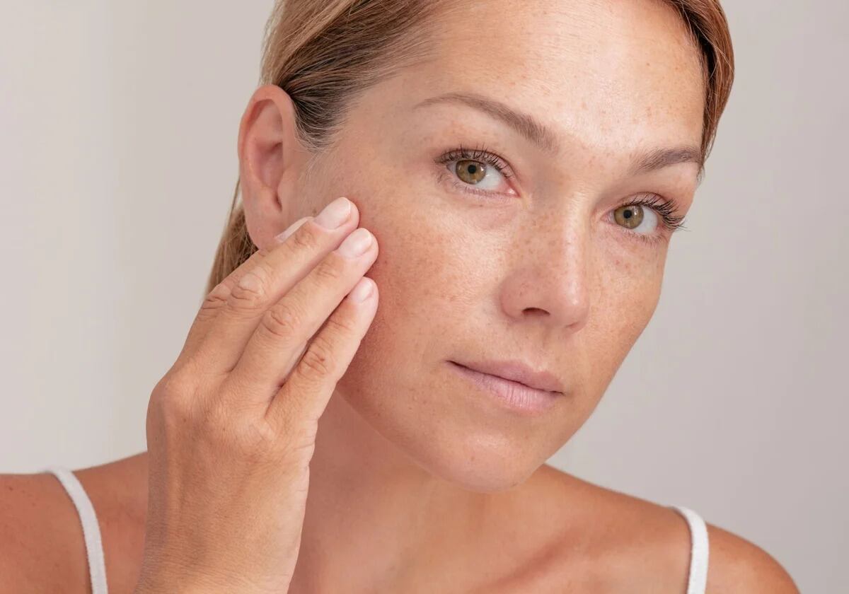 Qué tipos de manchas en la piel existen y a qué edad aparecen