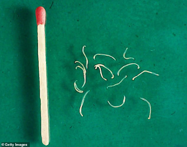 A little-known parasite — hookworms (pictured) — could be crawling in your gut