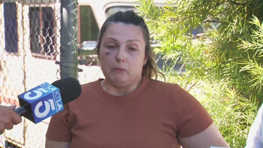 California woman says she was attacked before her baby was kidnapped(01)