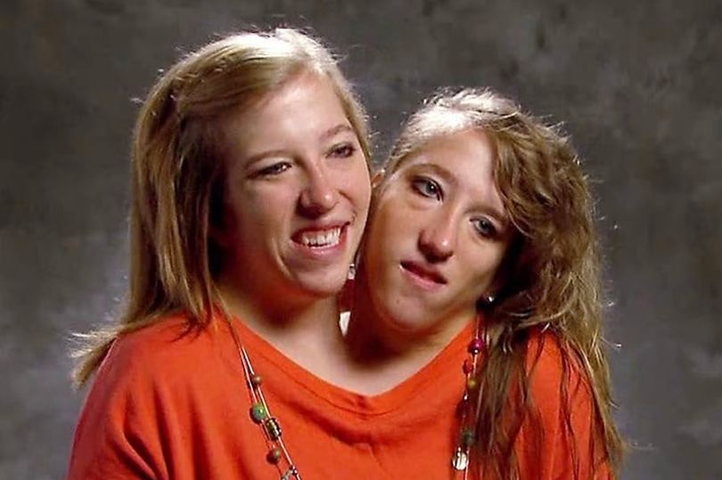 Conjoined twins Abby and Brittany Hensel spotted out with baby after(02)