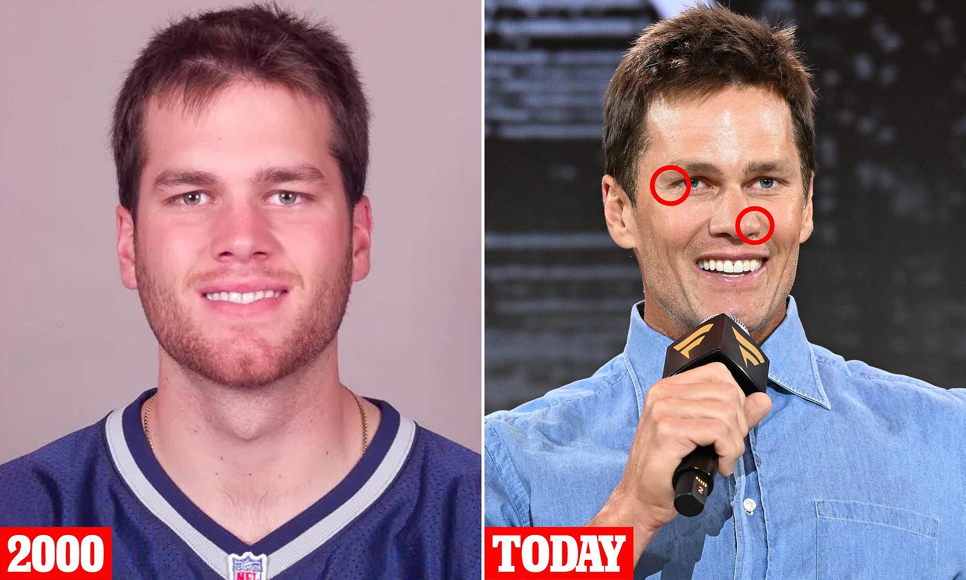 Plastic surgeons reveal what could be behind Tom Brady's changing