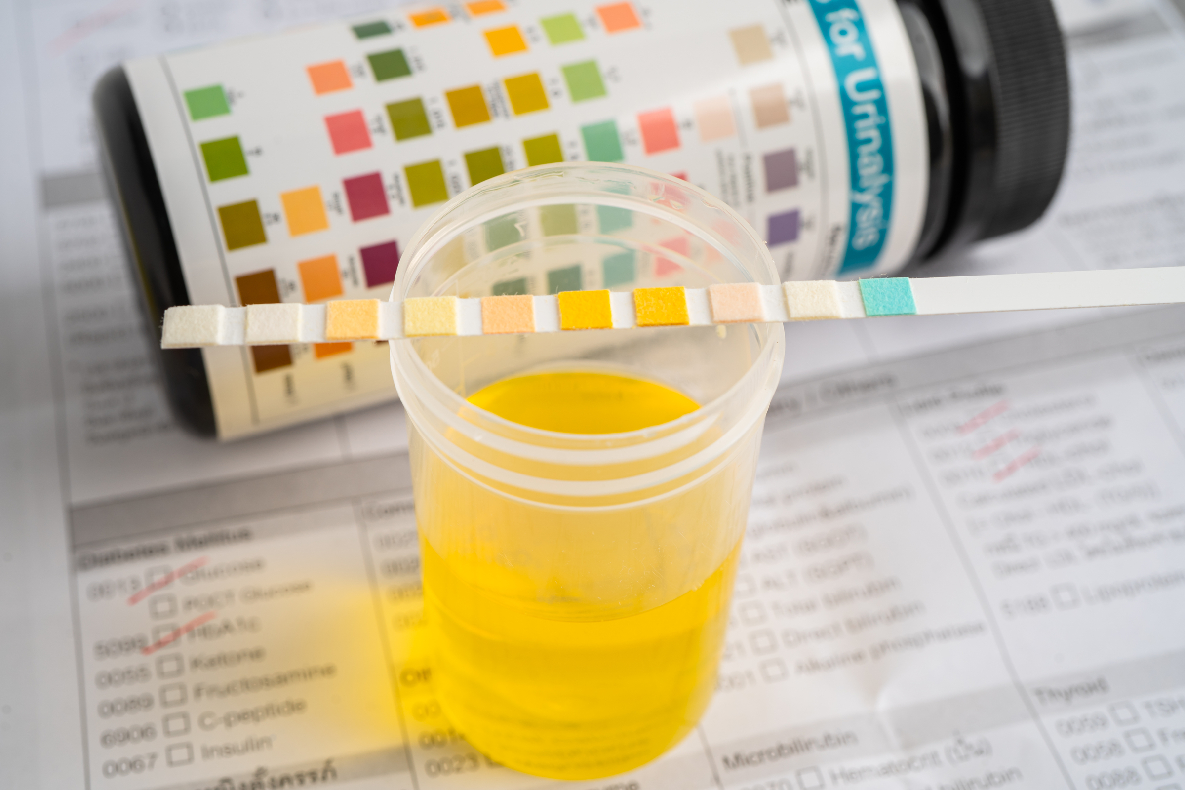 Xét nghiệm nước tiểu có giúp phát hiện nhiễm HPV không?