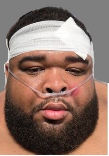 Florida state trooper taken to hospital following Escambia County