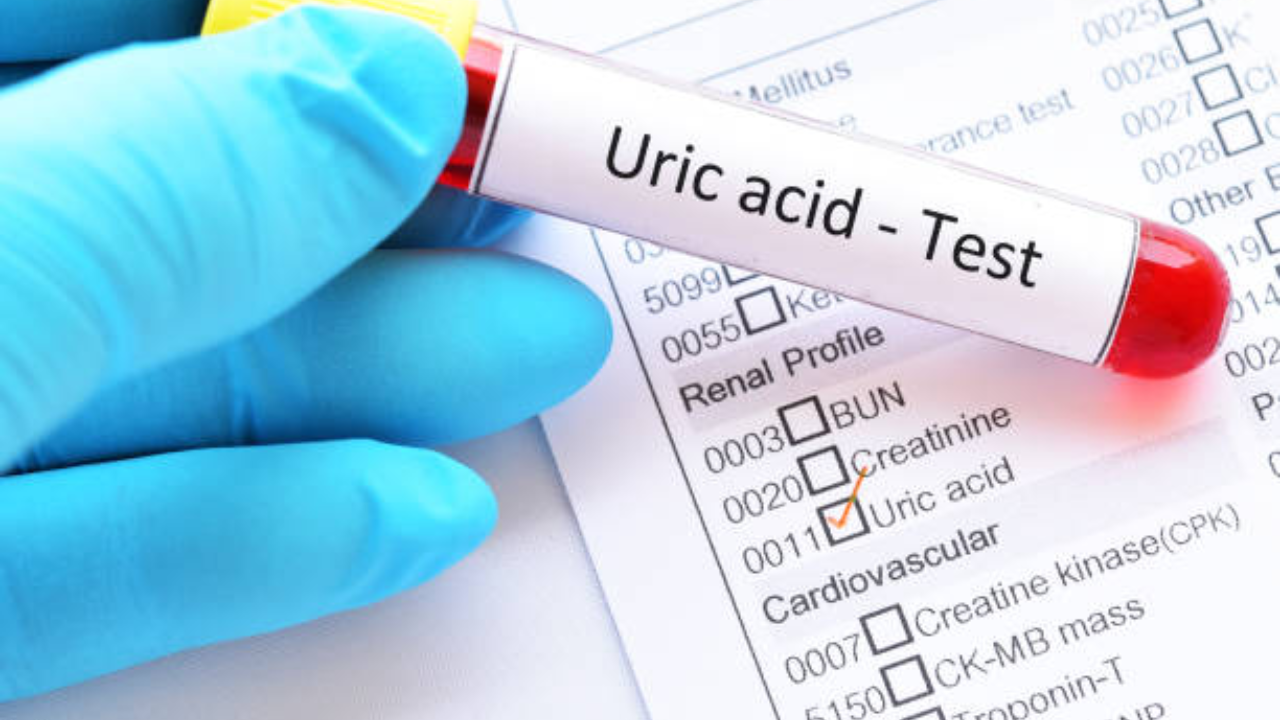 View of High uric acid levels linked to high BP, diabetes and heart disease ...