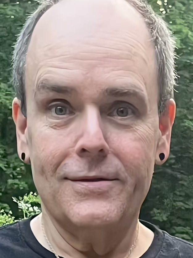 This Man's Mexico Facelift Has Everyone's Jaws On The Floor, And Over 6