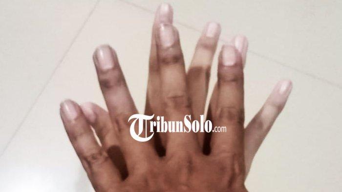 Perjuangan Ibu Korban Predator Seksual di Solo: Jejak 3 Bulan Pelaku Tertangkap