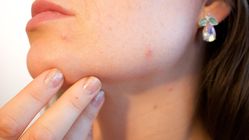 Mitos atau Fakta: Pepaya Bisa Hilangkan Flek dan Bekas Jerawat?