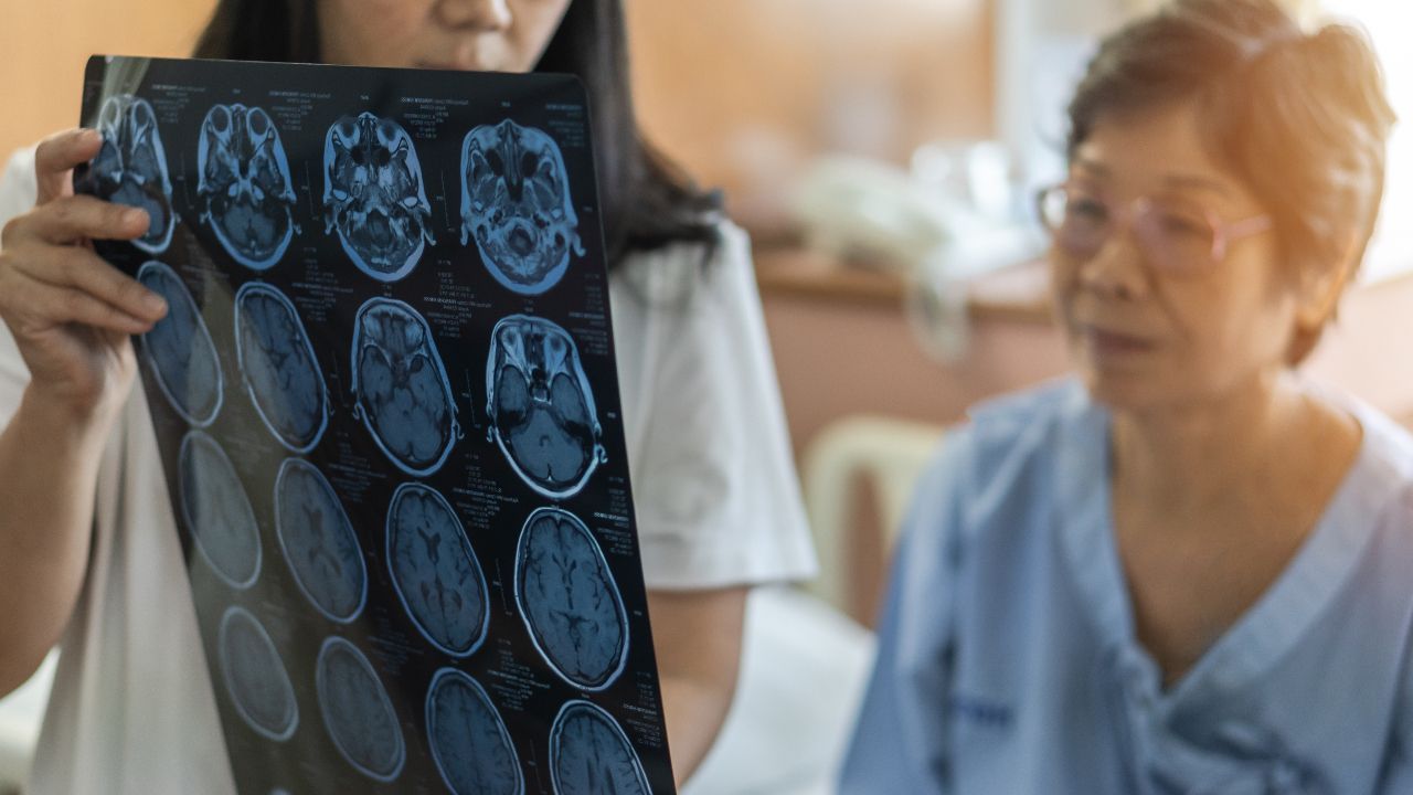 Silent Stroke สู่ Stroke นาทีชีวิต ภัยเงียบสมองขาดเลือด ที่ป้องกันได้ถ้ารู้ทัน