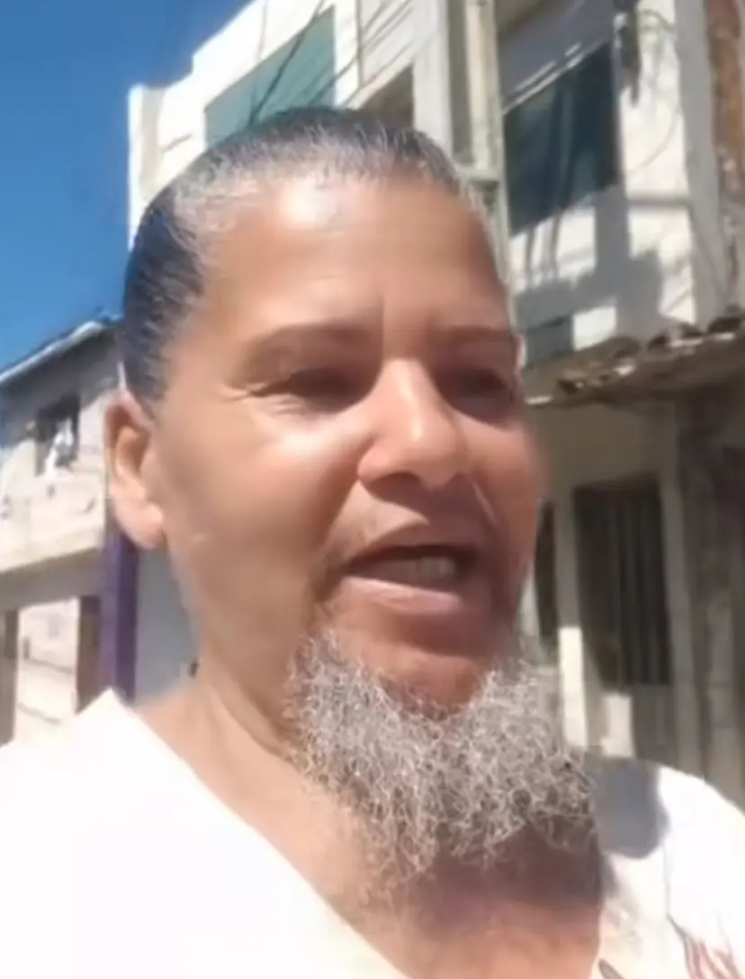 Mulher decide não raspar mais a barba e diz não se importar com críticas - Foto: Reprodução