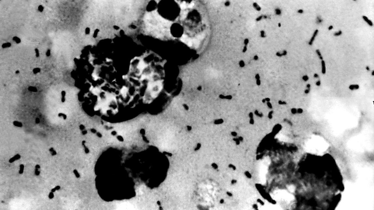 South Lake Tahoe resident tests positive for the plague