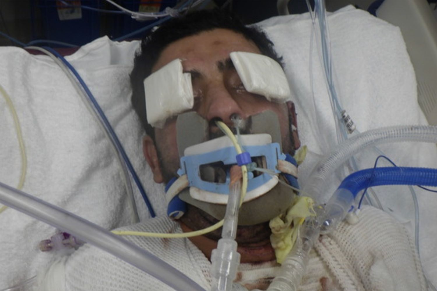 Do You Recognize This Man? Hospital Asks for Help Identifying 34Year(00)