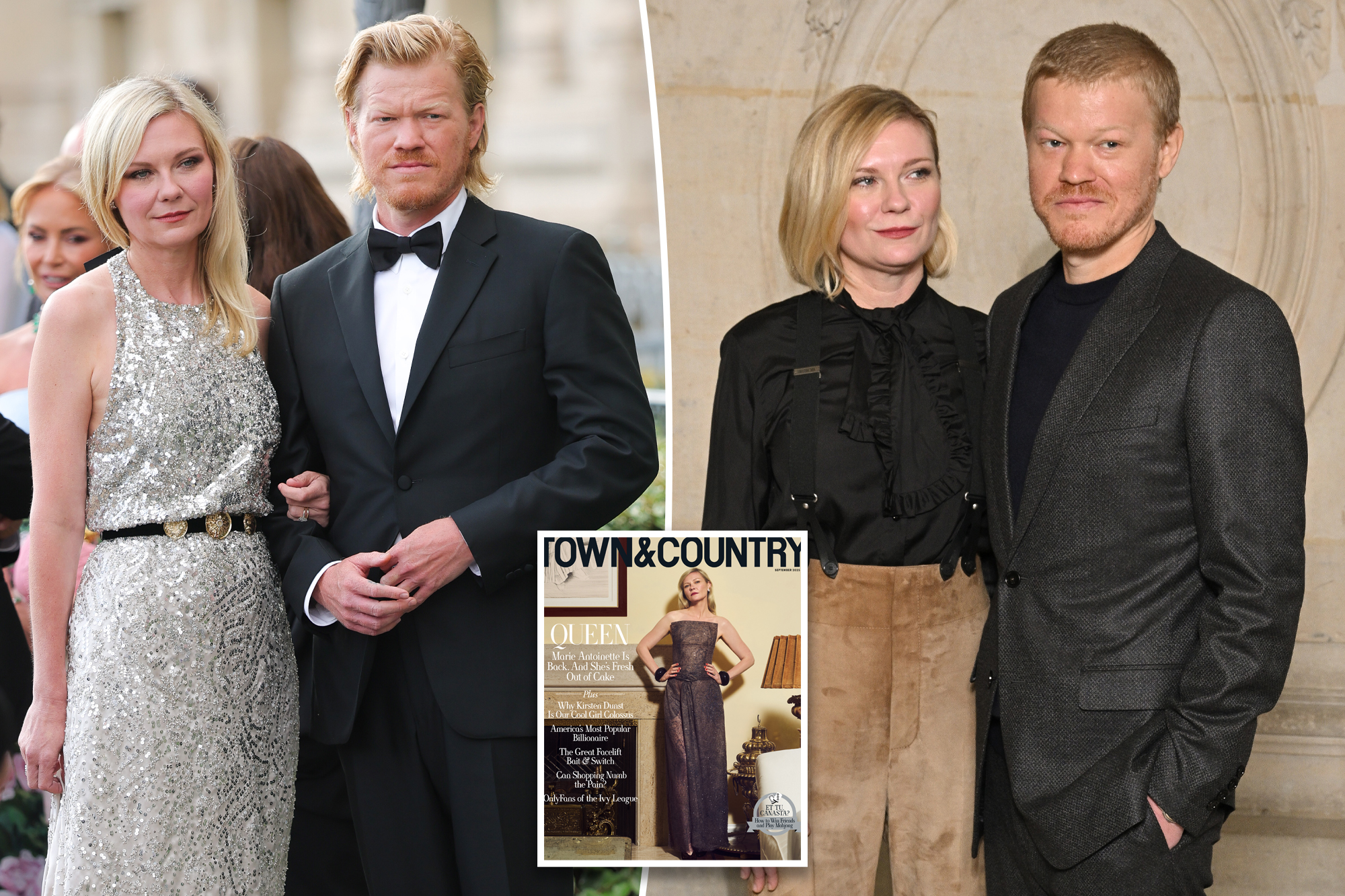 Kirsten Dunst and Jesse Plemons’ son James, 4, suffered a ‘serious