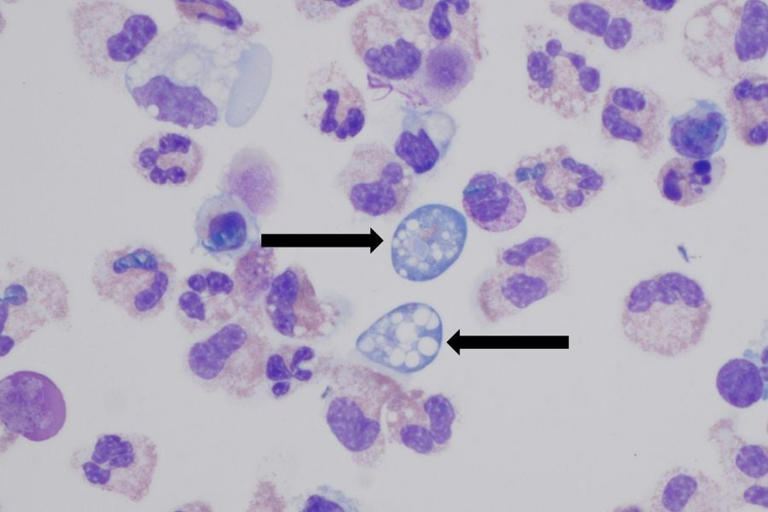Brain-eating amoeba found in water at several western national parks