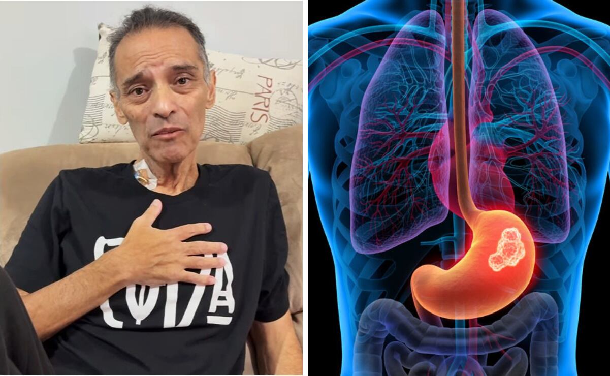 El reconocido cantante <strong>Xava</strong> Drago, <strong>vocalista</strong> de la emblemática banda <strong>Coda</strong>, fue diagnosticado con cáncer gástrico agresivo en 2024. Foto: El Universal