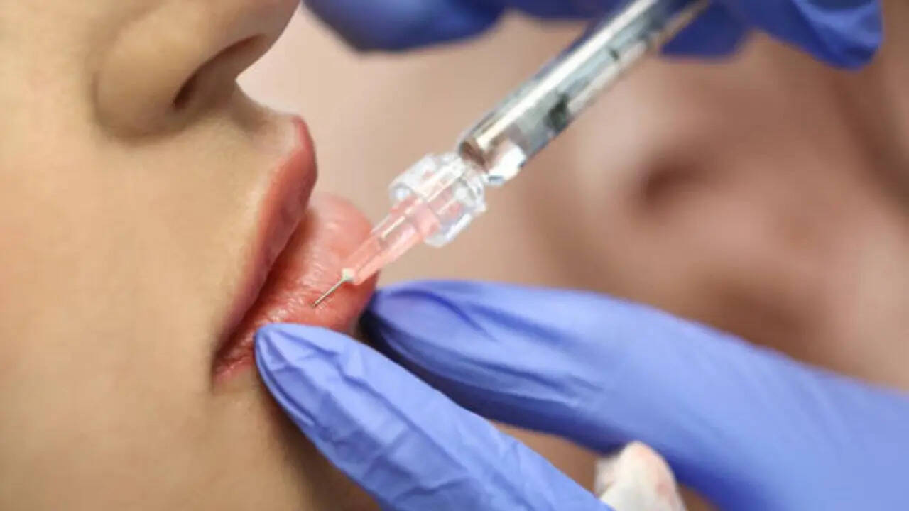 Fillers Are Not a Joke What Every Influencer Should Know Before Going