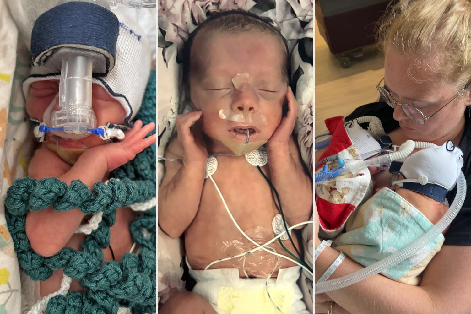 Moms Quadruplets at 29 Weeks. Now, They Are 'Counting Down the