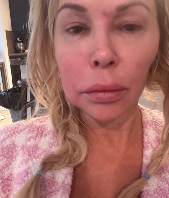 Brandi Glanville Burns Her Skin With Nair for This Reason