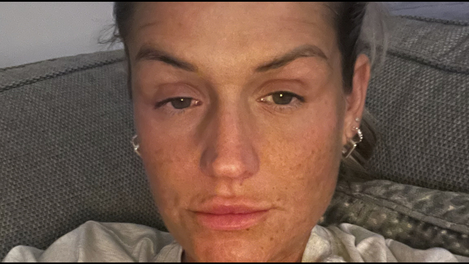 "My codeine addiction saw me consume 120 a day - I kept it secret for 3