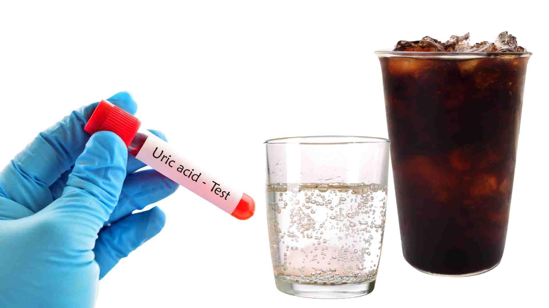 Loại đồ uống sử dụng thường xuyên giúp giảm axit uric hiệu quả