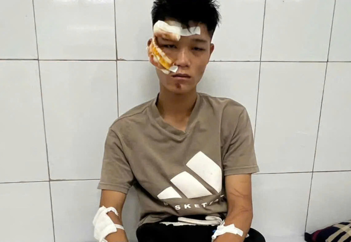 "Quái xế" Nguyễn Văn Quân đang điều trị tại bệnh viện.