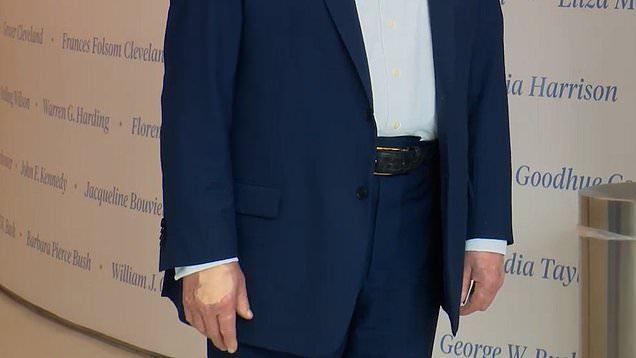 Trump spotted with heavy makeup on right hand | Watch