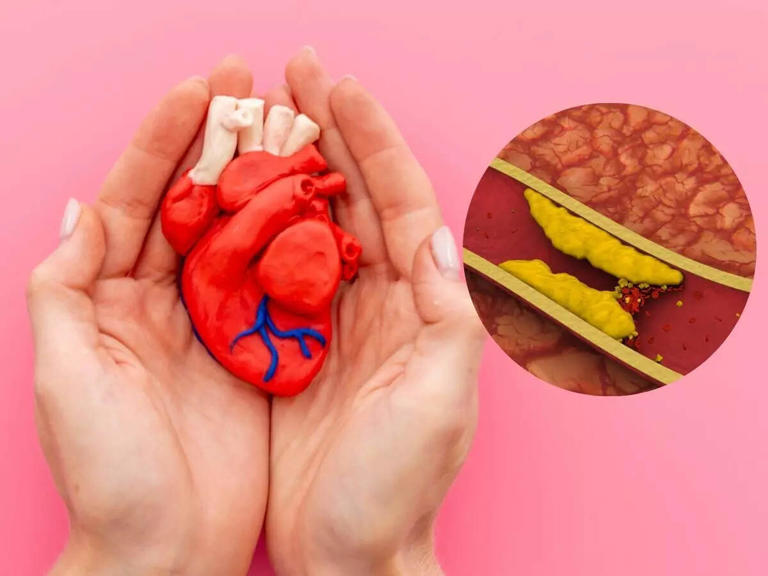 New York-based doctor shares ways to clear the sticky layer of fat and cholesterol in arteries, a major cause of heart attack