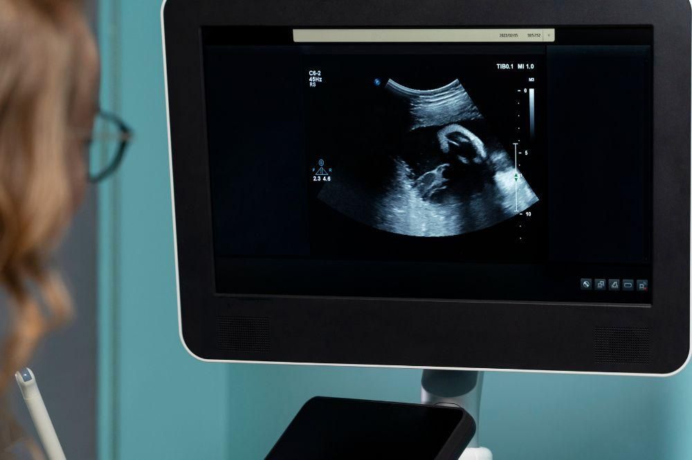 Saat Proses Persalinan, Bayi Ini Lahir Pegang IUD sang Mama 2 AA1LHyzp