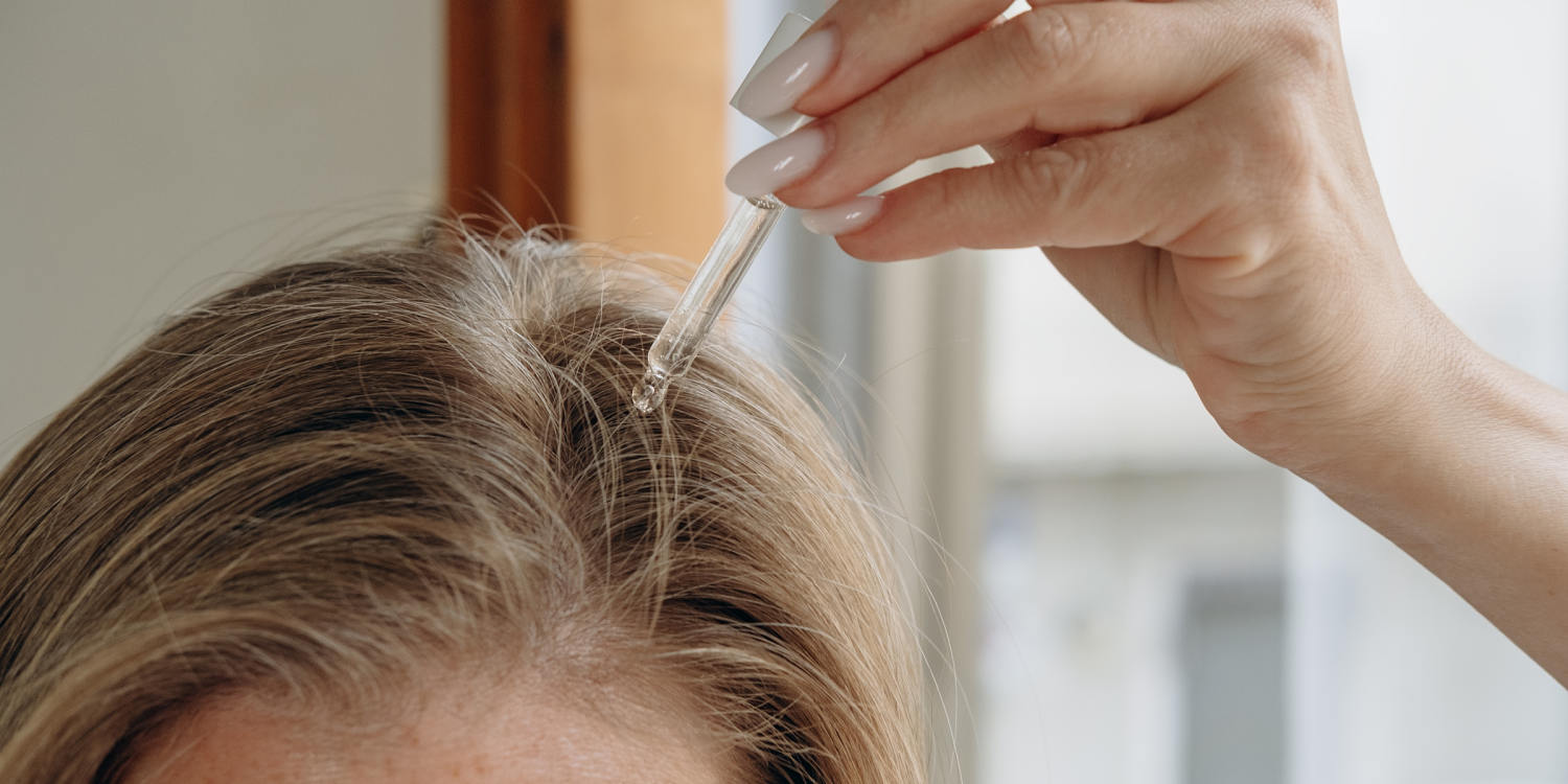 Thinning hair? Don't panic — here's how to treat it