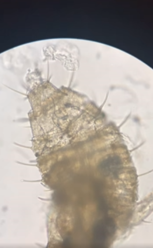 Bacteria, Worms & Rotifers… You Won’t Believe What’s Hiding Here!