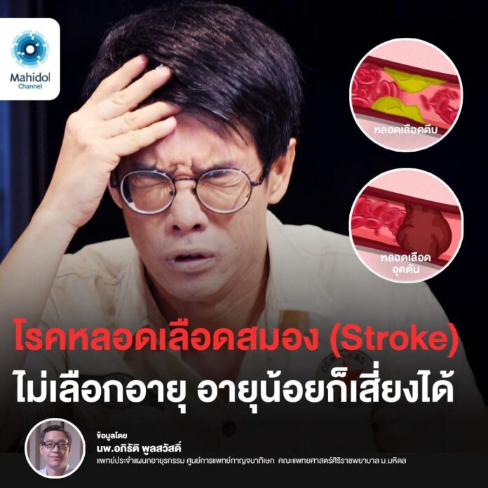 หมอเตือน อายุน้อยก็ป่วย โรคหลอดเลือดสมอง ได้ เช็ก 3 อาการอันตราย รีบพบแพทย์