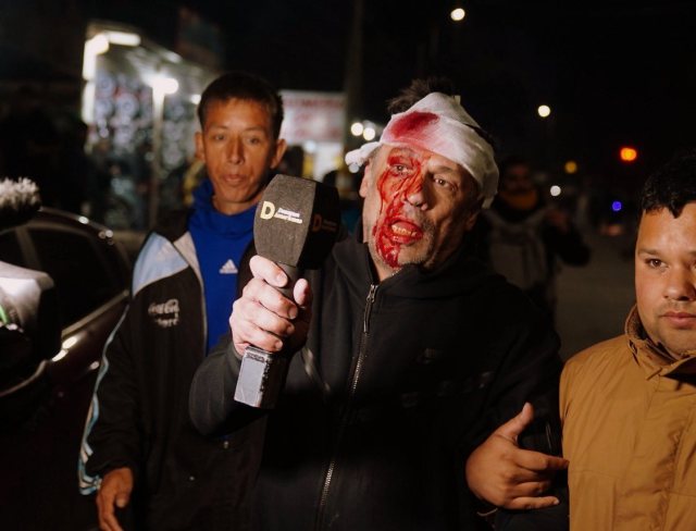 El periodista Cristian Mercatante resultó brutalmente agredido – Foto: Captura de pantalla