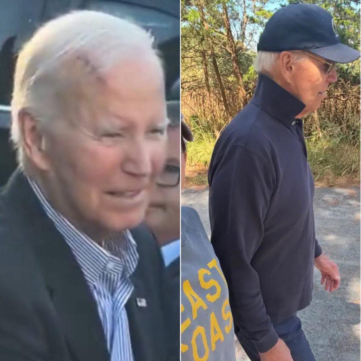 Joe Biden met een litteken op zijn voorhoofd.