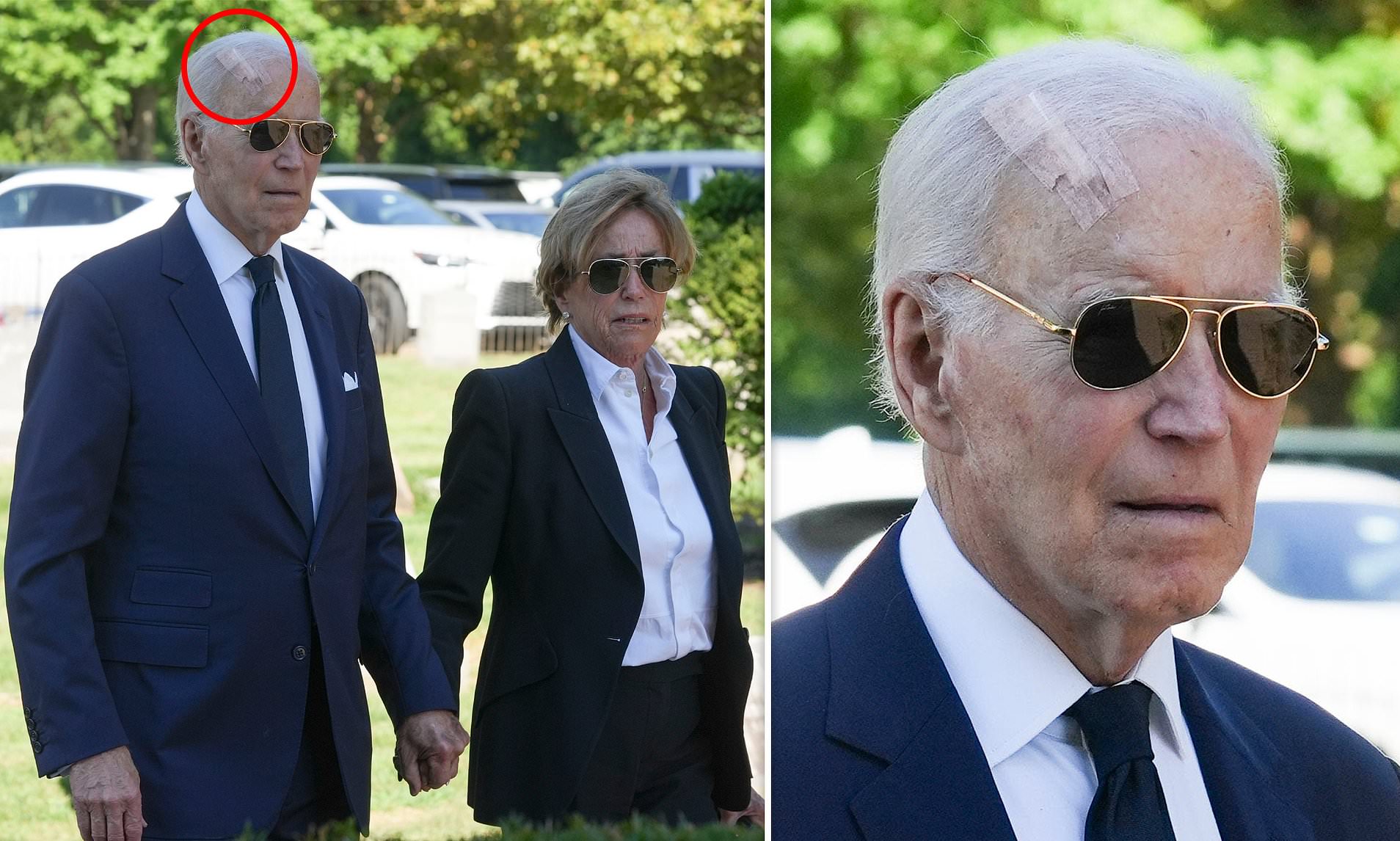 Joe Biden attends meetandgreet with head scar after undergoing Mohs