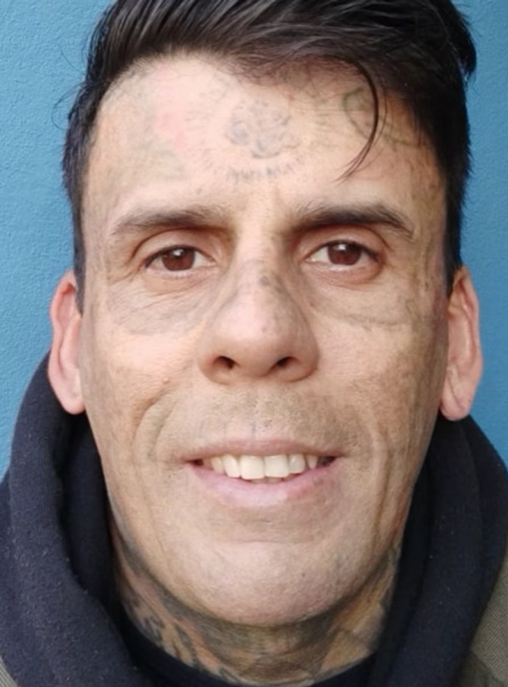 Man Who Was 95 Tattooed Shows Shocking Transformation After Laser