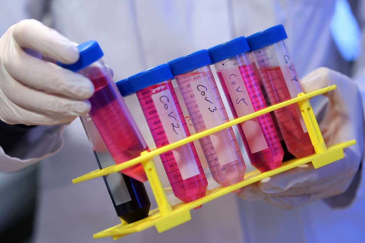 Long Covid could trigger symptoms similar to Alzheimer’s, study says