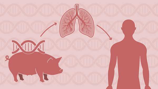 Primeiro pulmão de porco transplantado para corpo humano funciona por nove dias