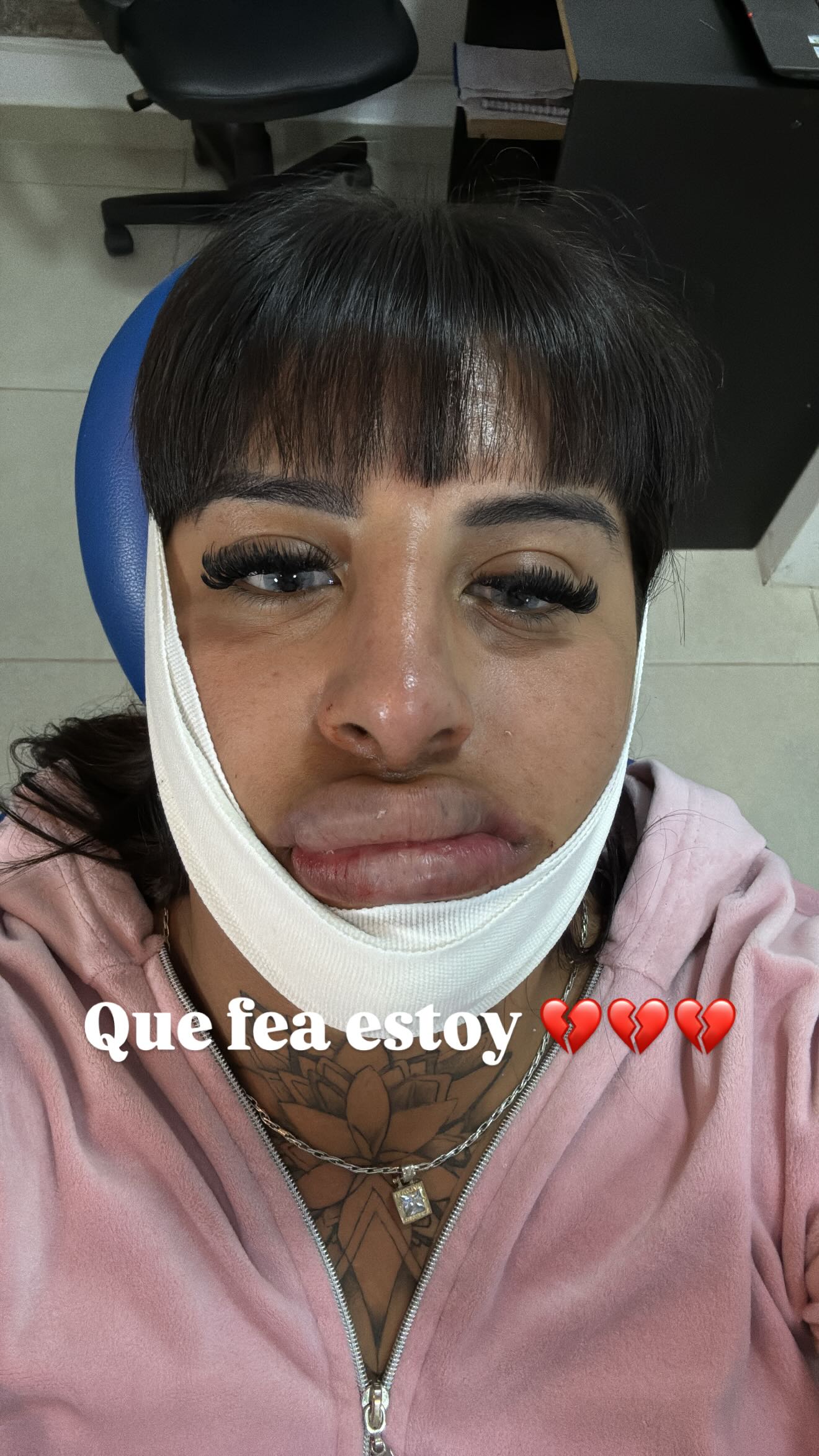 la-coqueta-mostr-el-antes-y-despu-s-de-su-nuevo-retoque-en-los-labios