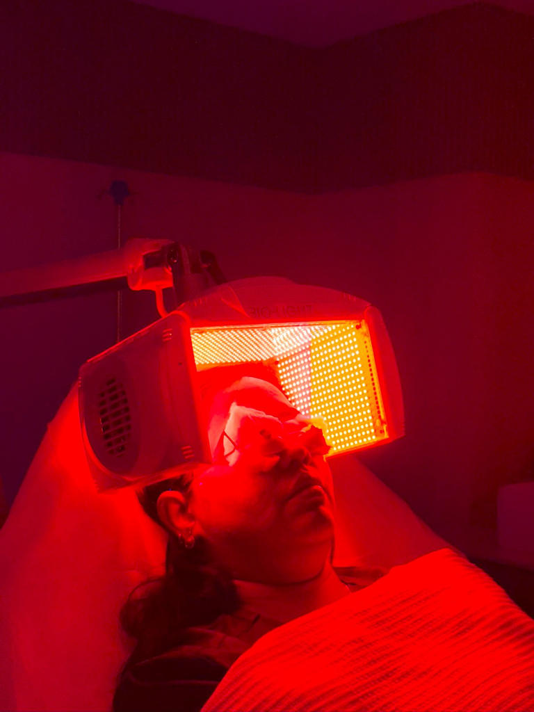 Regrow with Red: How LED Therapy is Changing the Hair Loss Story