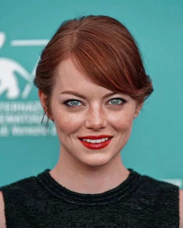 15 Celebrities Who Embrace Their Natural Freckles