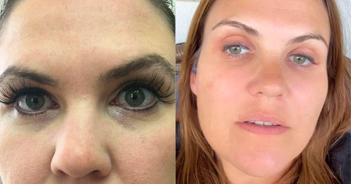 Woman Got Tattooed Eyeliner to ‘Save Time’ and Instantly Regretted It