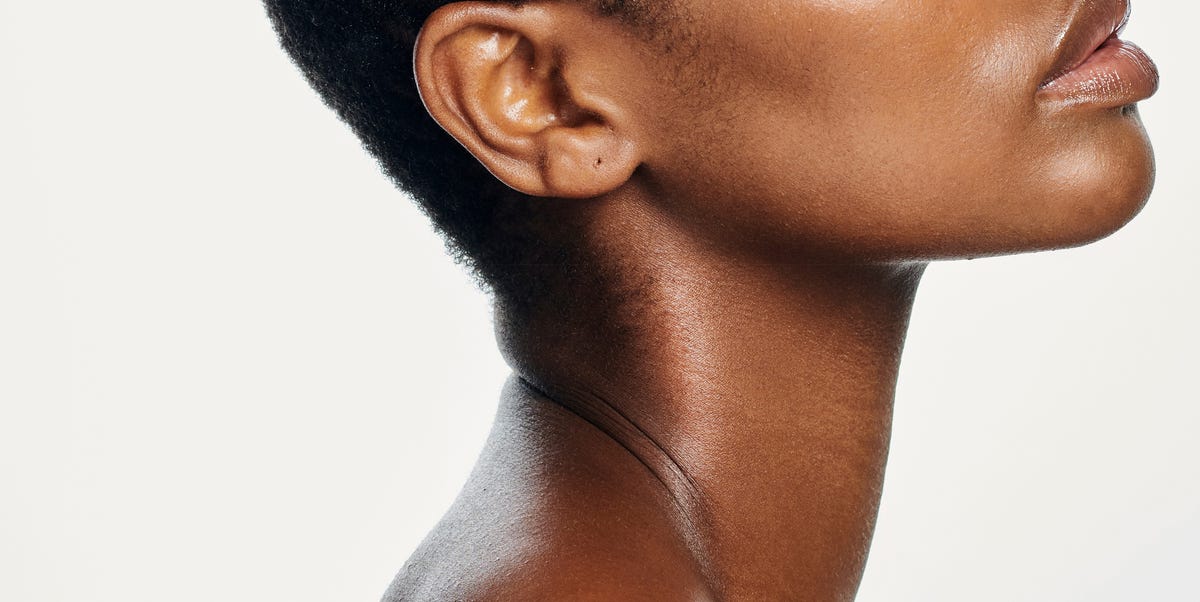 Dermatologists say these neck-firming treatments really work—no surgery required