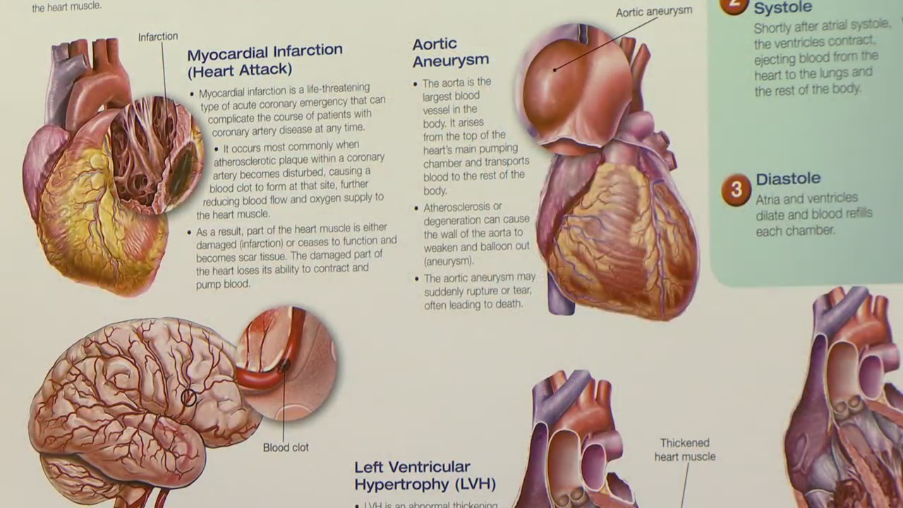 NEW HEART HEALTH GUIDELINES visual data 5