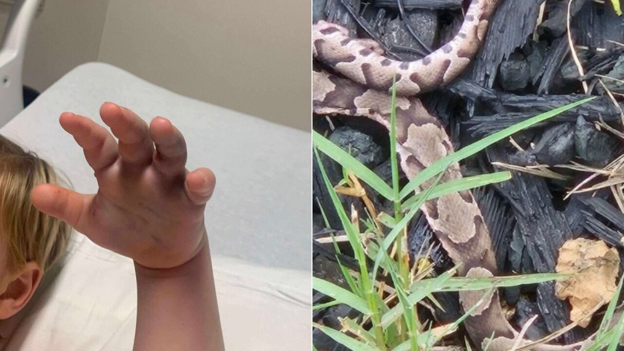 alexander-county-daycare-responds-to-copperhead-snake-bite-incident