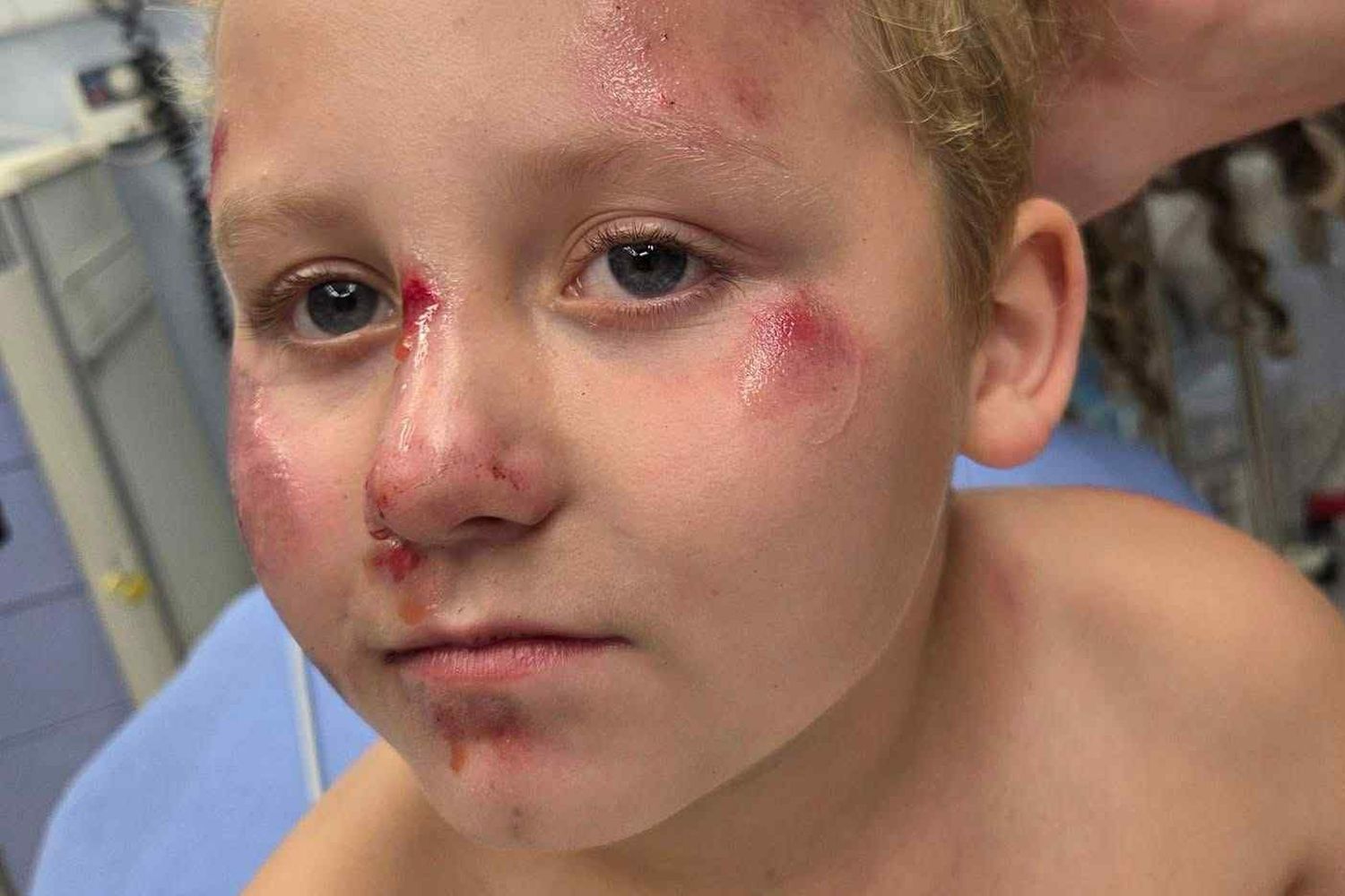 Boy, 8, Was Struck by Car While Riding His Bike. Witnesses Saw the