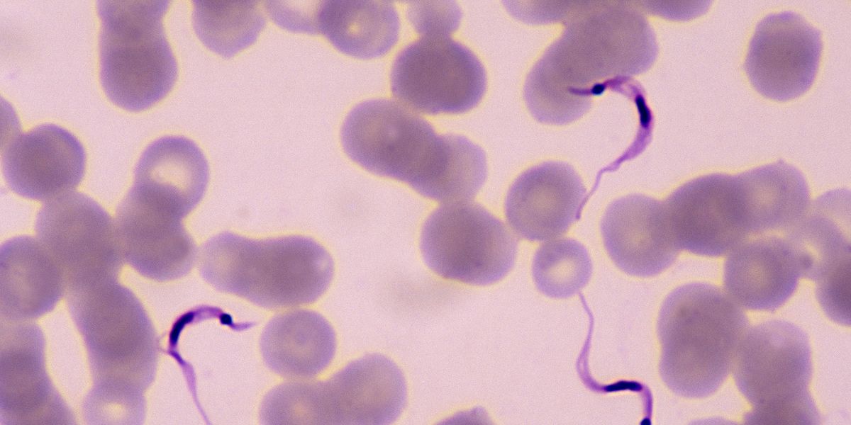 This Deadly Disease Needs to Be on Your Radar