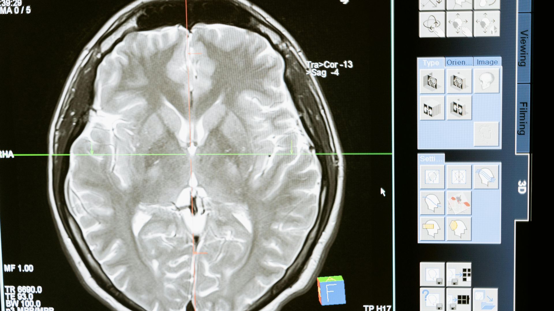 A startup is keeping human brain cells active after death. Could it ...